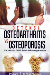 Image of Deteksi Osteoarthritis VS Osteoporosis