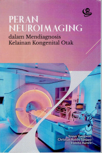Image of PERAN NEUROIMAGING DALAM MENDIAGNOSIS KELAINAN KONGENITAL OTAK