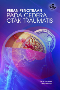Image of PERAN PENCITRAAN PADA CEDERA OTAK TRAUMATIS